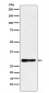 Anti-DDAH2 Monoclonal Antibody